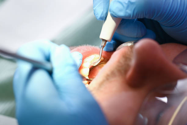 Best Emergency Dental Care for Sports Injuries in Bath, ME